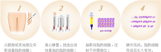 除皱示意图