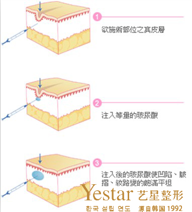 瑞蓝